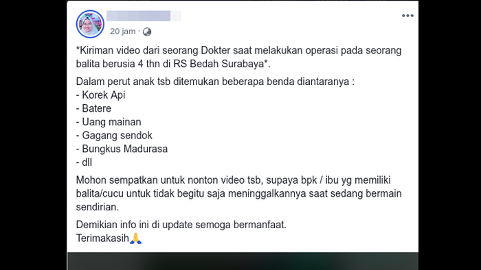 Viral Video Operasi Perut Balita Berisi Korek Api, RS Bedah Surabaya: Itu Hoaks!